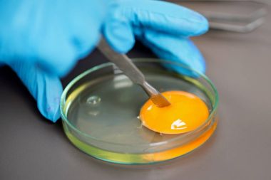 人萊姆IgG(Lyme-IgG)ELISA Kit試劑盒/測(cè)試盒 人萊姆IgG(Lyme-IgG)ELISA Kit試劑盒/測(cè)試盒