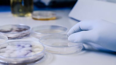 人抗增殖細(xì)胞核抗原抗體(PCNA)ELISA Kit試劑盒/測試盒 人抗增殖細(xì)胞核抗原抗體(PCNA)ELISA Kit試劑盒/測試盒